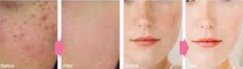 Phấn nước Agc Blue Diamond (Ảnh 4)