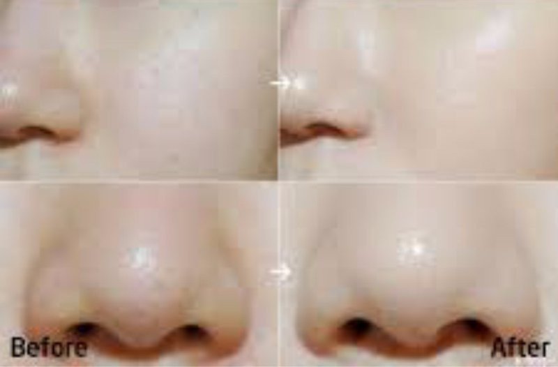 Phấn nước Agc Blue Diamond (Ảnh 6)