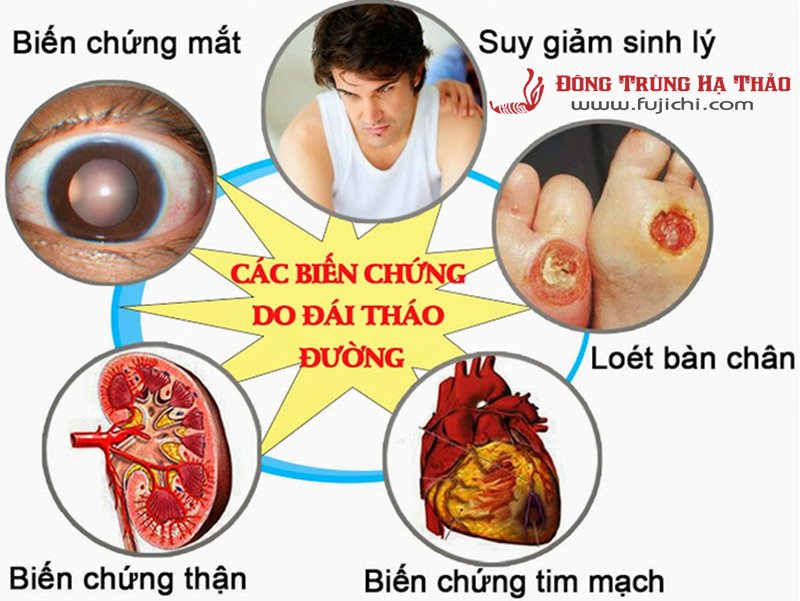 Nấm Lim xanh rừng Quảng Nam (Ảnh 2)